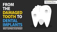 From The Damaged Tooth To Dental Implants: What Happens In Between?