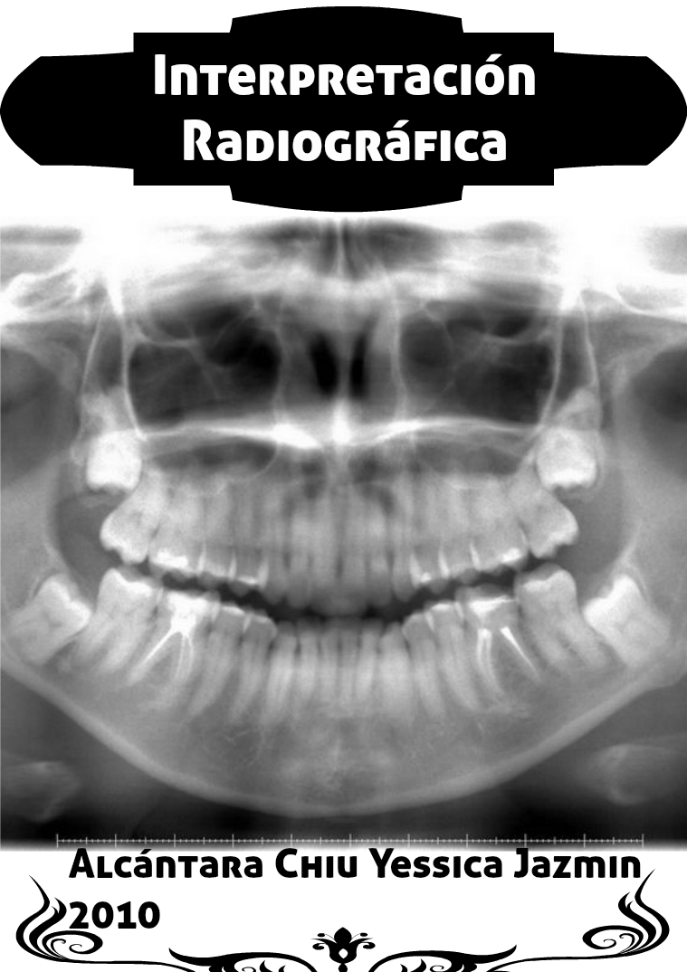 Interpretación Radiográfica Vol. 1