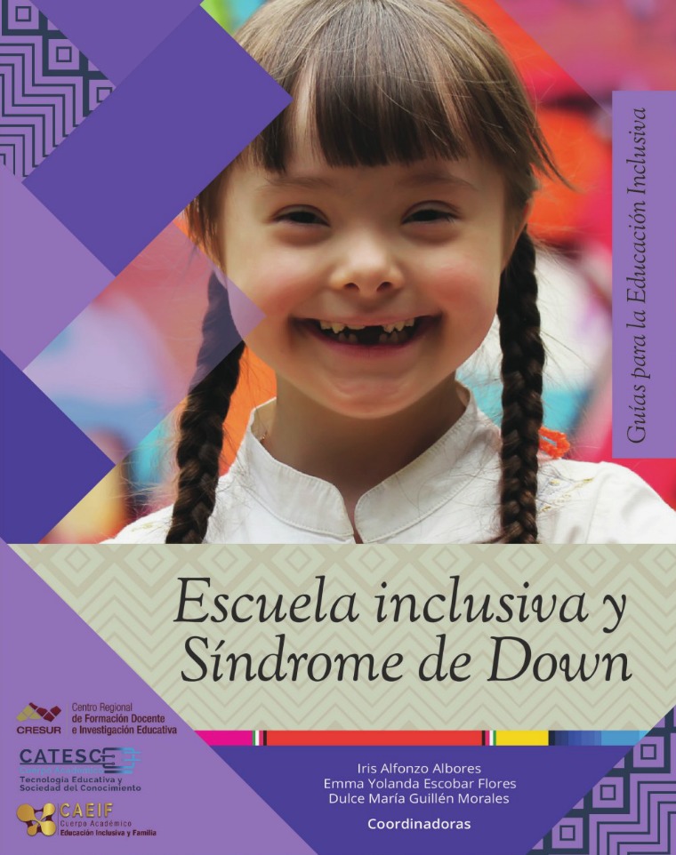 Síndrome de Down sindrome_down