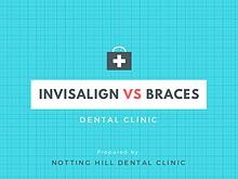 What is Invisalign - Comparison Between Invisalign and Braces