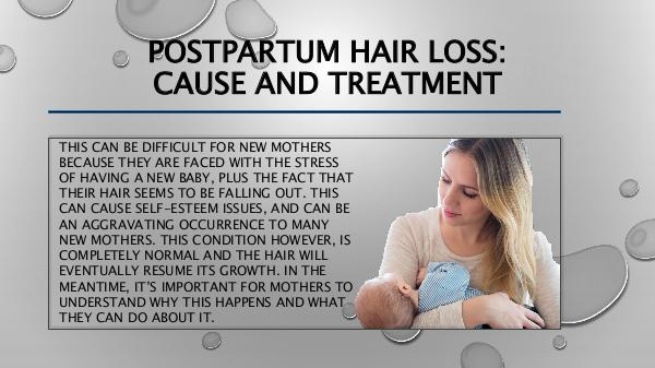 Postpartum Hair Loss Cause and Treatment Postpartum Hair Loss Cause and Treatment