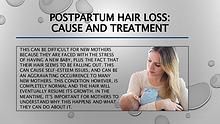 Postpartum Hair Loss Cause and Treatment