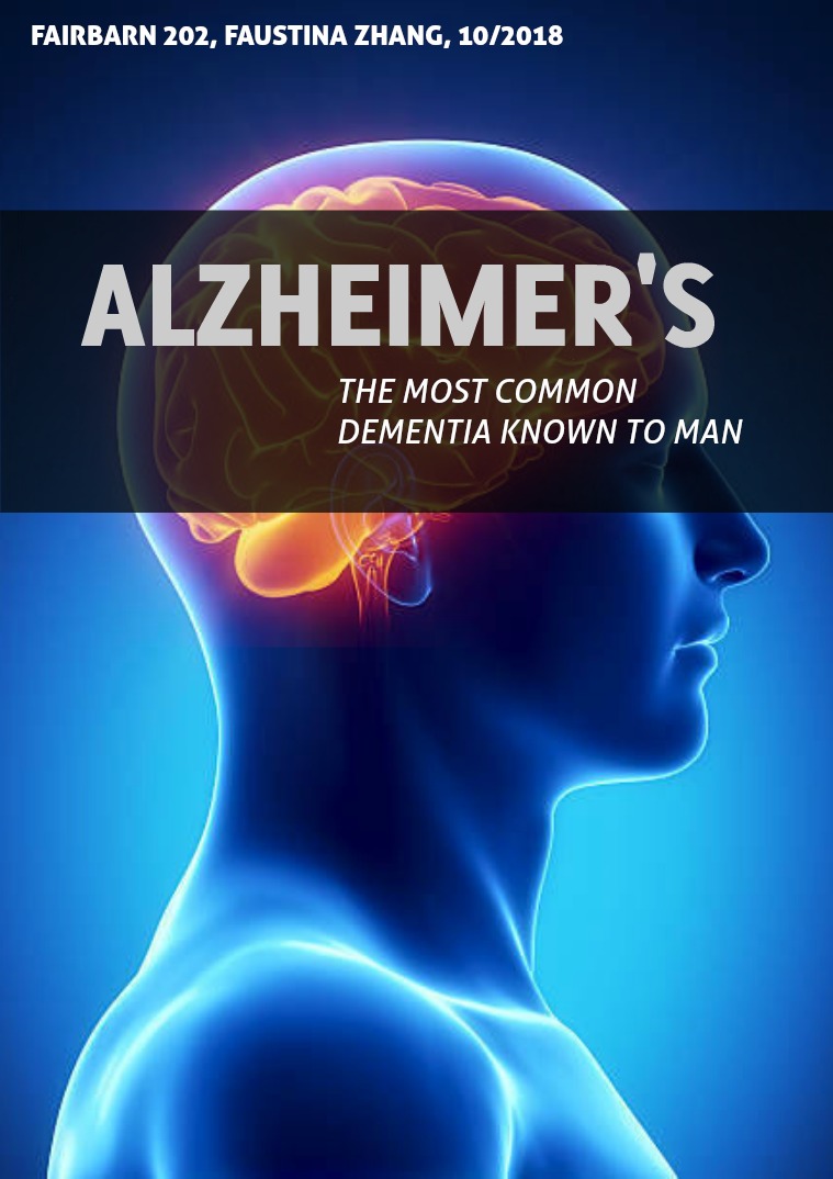 Alzheimer's Disease -- Cell Disease Report Cell Disease Report