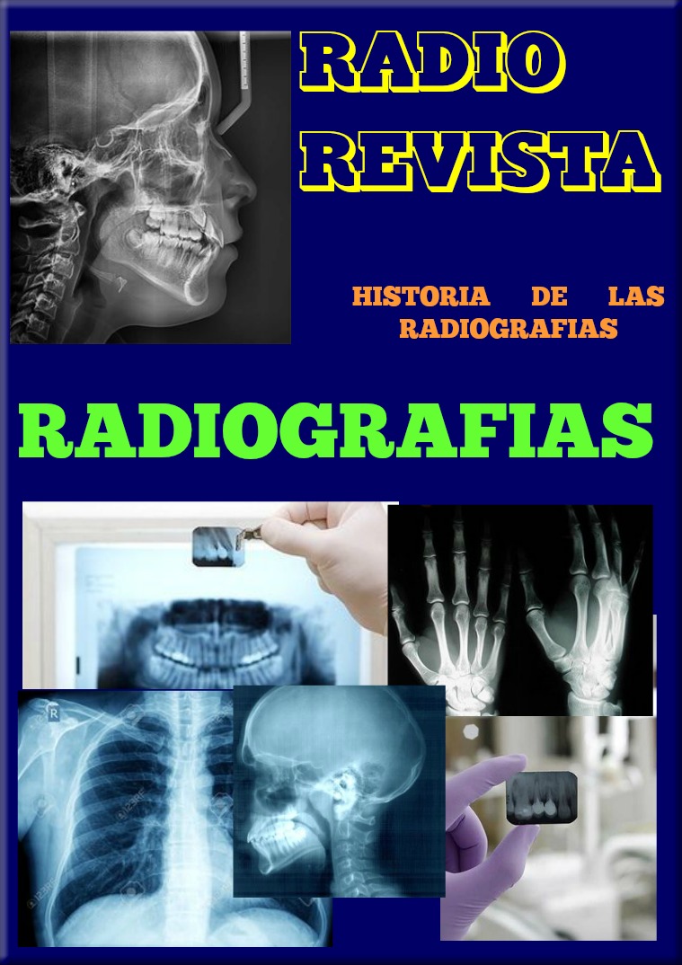 Radiografias, Fscultad de Odontologia Radiografias y  radiografias dentales