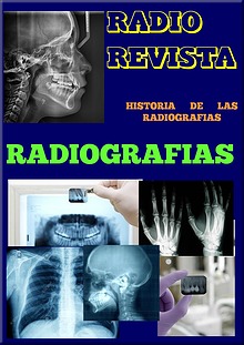 Radiografias, Fscultad de Odontologia