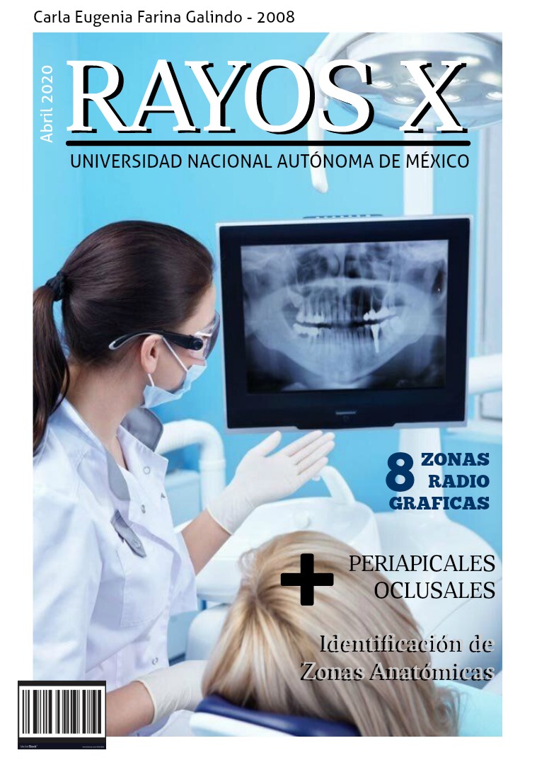 Zonas radiográficas en Odontología Odontología