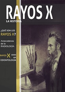 Rayos X: La Historia